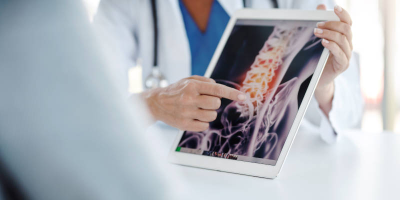 Treatment for Osteoporosis in Newmarket, Ontario
